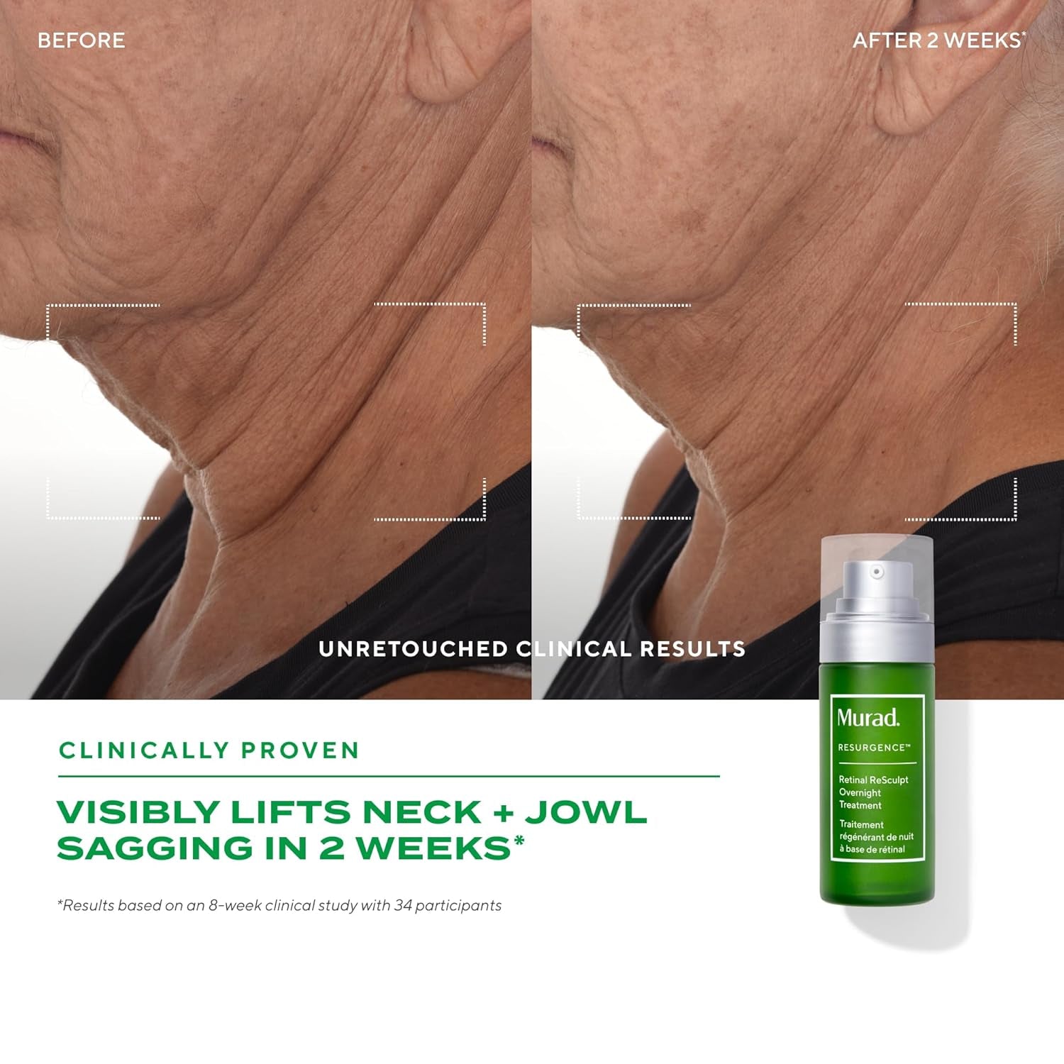 Retinal Resculpt Overnight Treatment - Advanced Face and Neck Serum with Encapsulated Retinal, Kangaroo Paw, Olive, & Oat Smooths Deep Wrinkles and Crepey Skin, & Lifts Sagging Skin