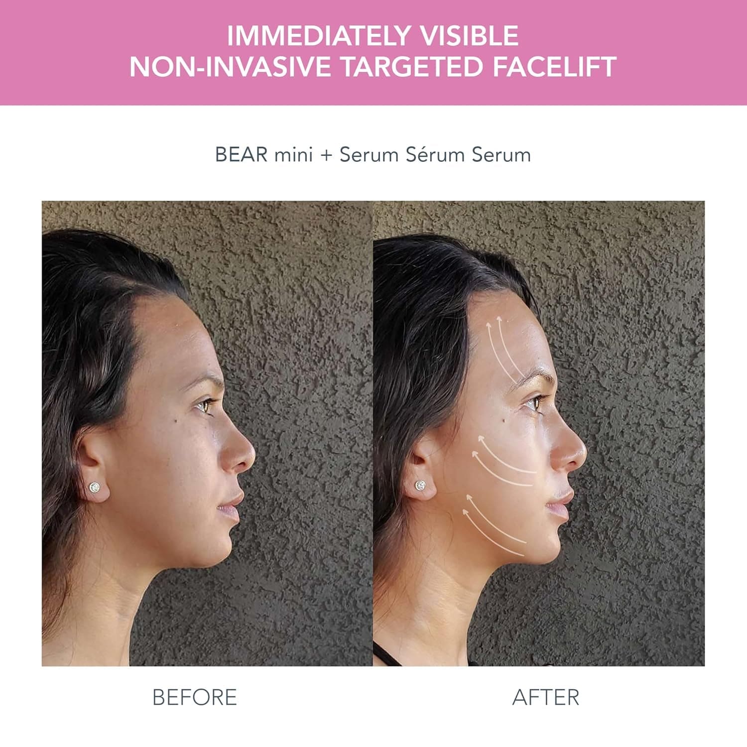 BEAR Mini Microcurrent Facial Device + UFO Mini 2 Face Mask Treatment + SERUM 1 Fl. Oz. + 6 UFO Power Activated Masks Skin Supremes Holiday Set