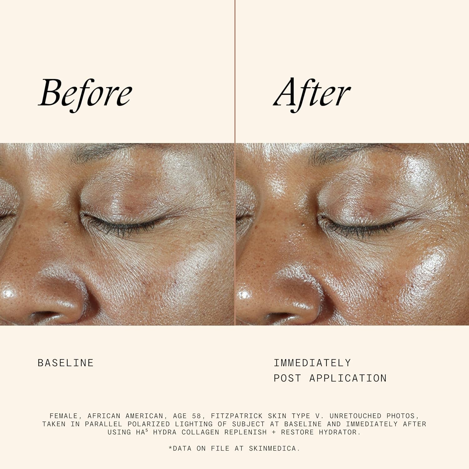 HA Hydra Collagen Replenish & Restore Hydrator - Age-Defying Skincare for Women with 2X Hyaluronic Acid than Previous Formula & Vegan Collagen for Hydration & Visibly Plump Skin (2 Fl Oz)