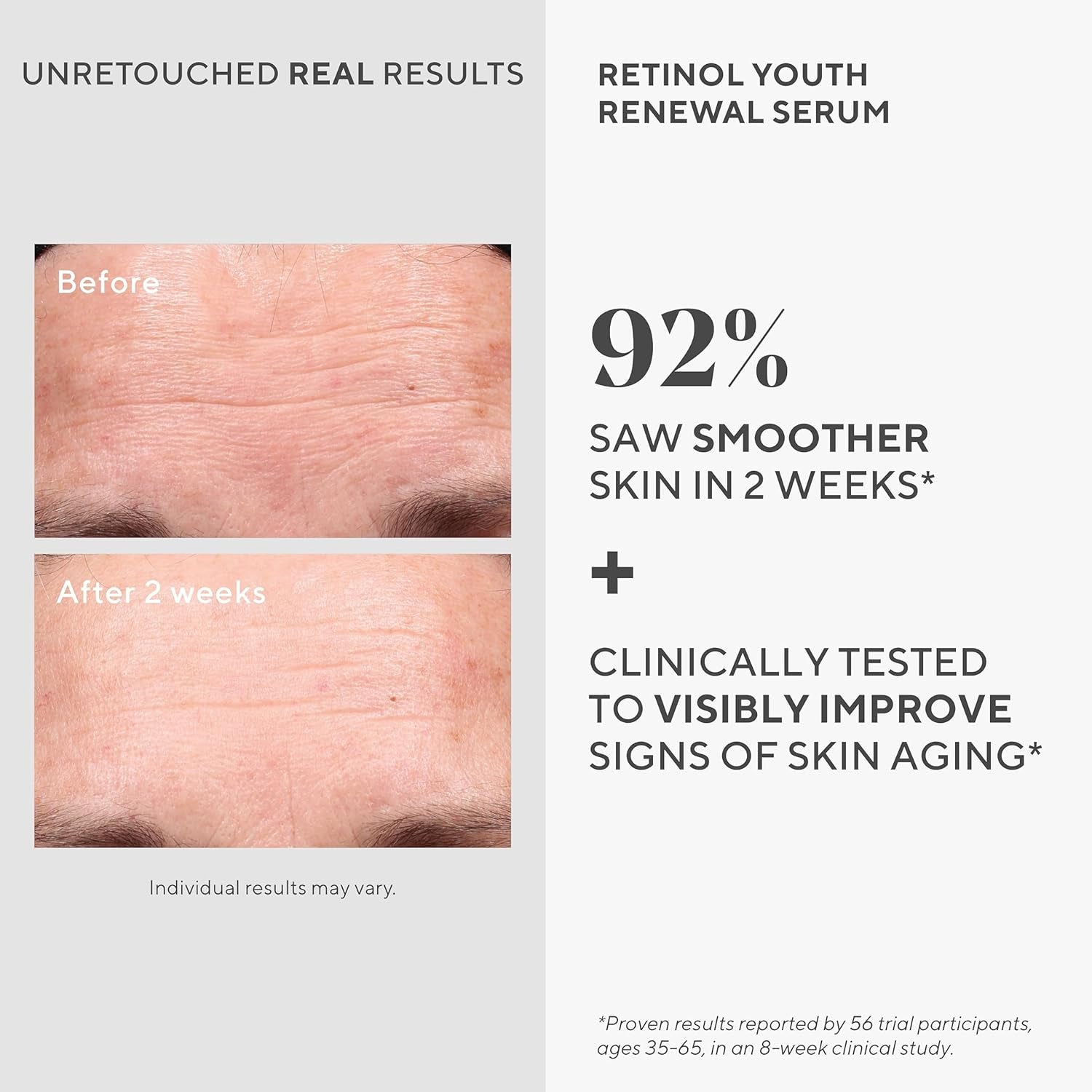 Retinol Youth Renewal Serum - Fast-Acting Retinol Treatment with Swertia & Hyaluronic Acid for Visible Anti-Aging Results - Tri-Active Technology Gently Reduces Wrinkles & Firms Skin