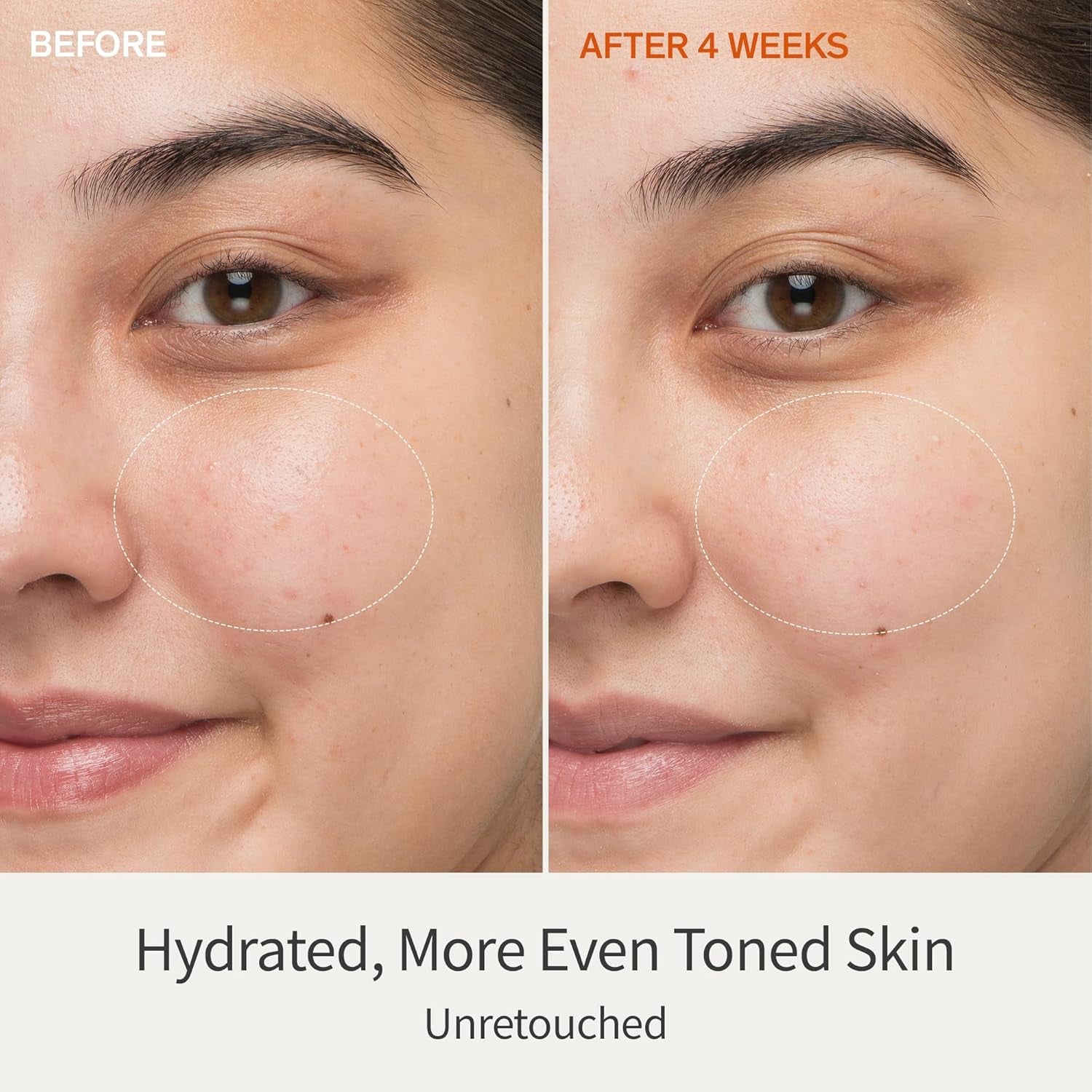 First Care Activating Serum - Skin Barrier Strengthening Anti-Aging Face Serum, Visibly Plumps & Hydrates, Reduces Visible Fine Line & Wrinkles, Vitamin C, Korean Skincare