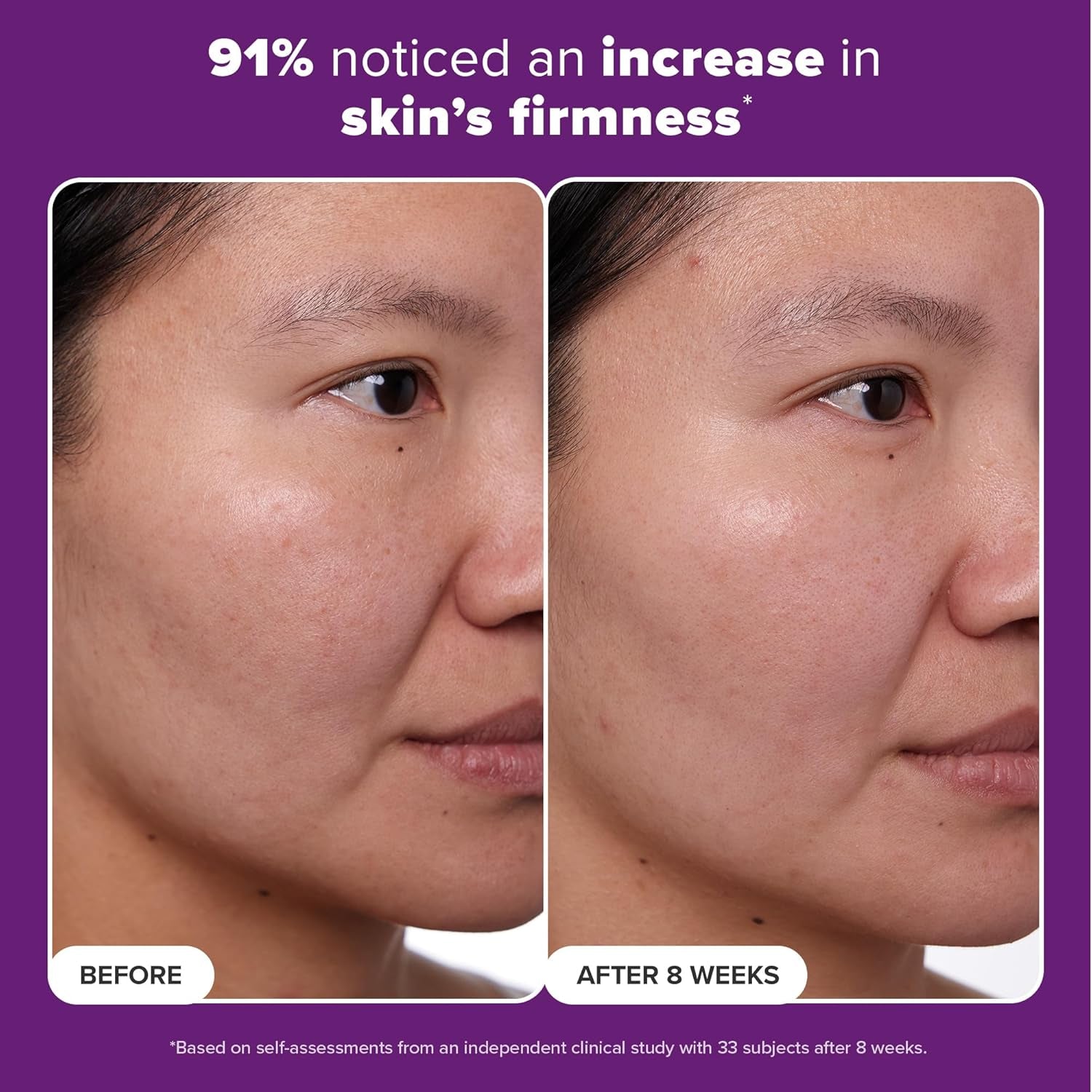 CLINICAL 1% Retinol Treatment with Peptides, Vitamin C & Licorice Extract, Firming Cream for Face, Anti-Aging & Wrinkles, Fragrance Free