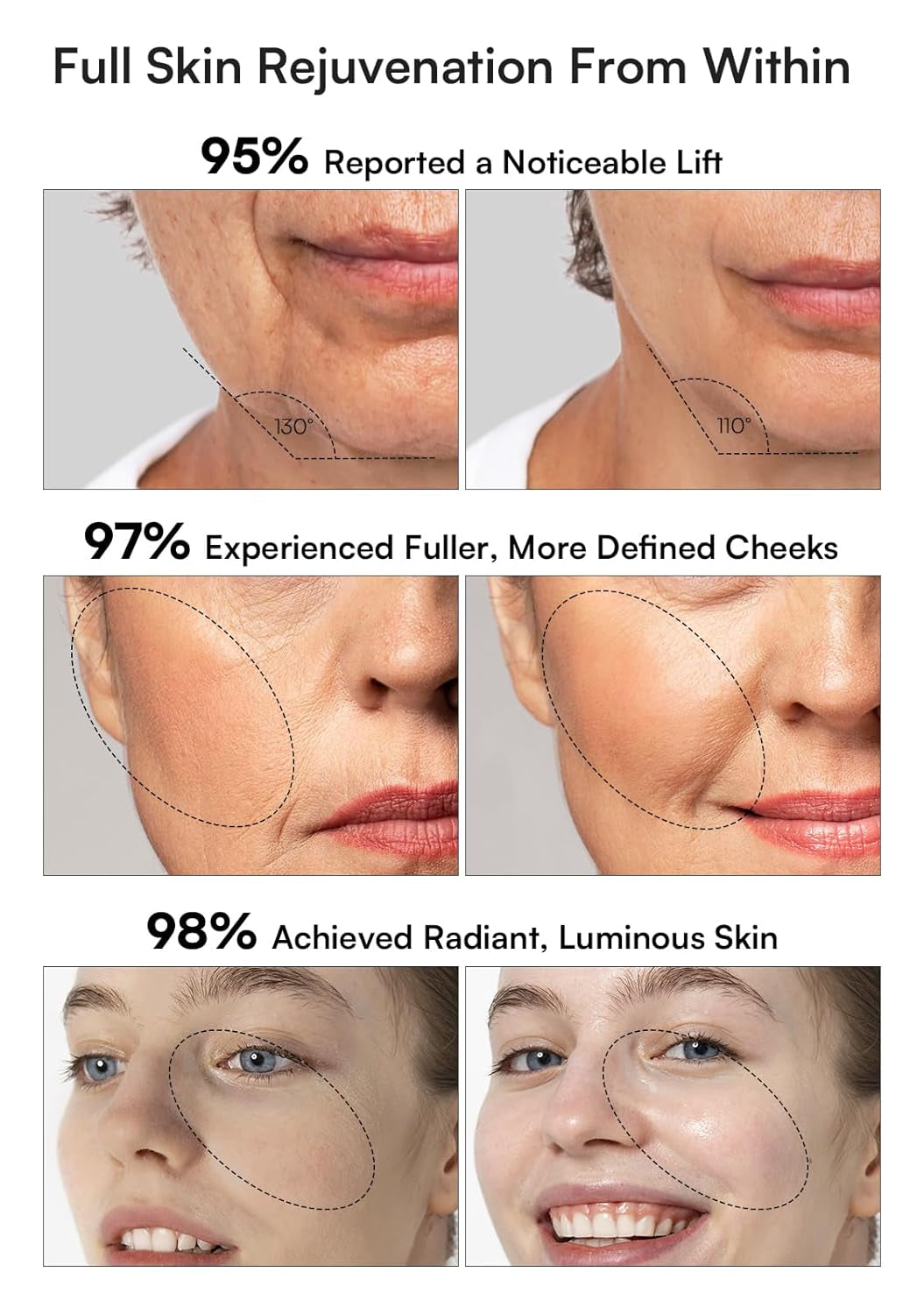 3-In-1 Red Light Therapy for Face and Neck, Skin Tightening Device True Beauty Glow Facial Massager for Skin Care, Effective Wrinkle Reduction Anti-Aging with Lifting, Tightening, Infusing