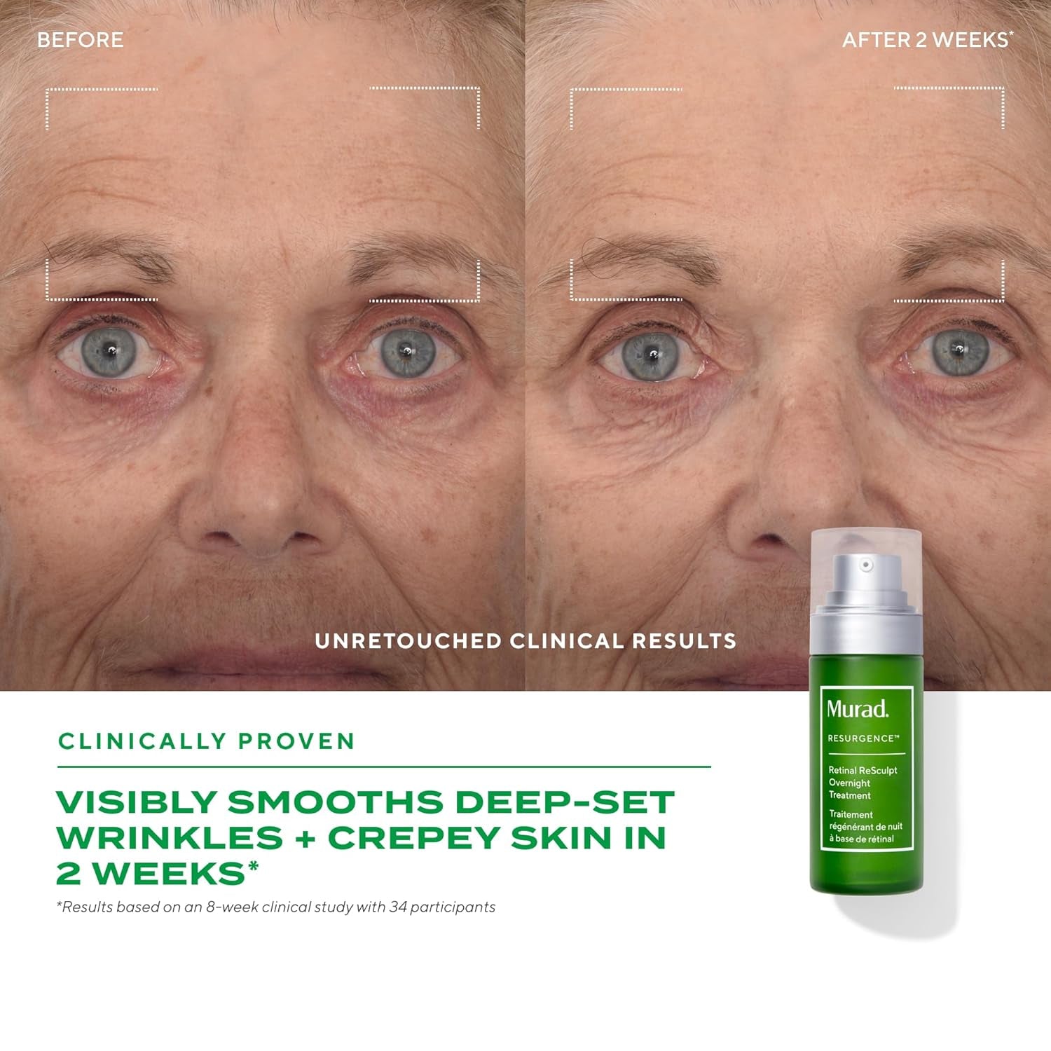 Retinal Resculpt Overnight Treatment - Advanced Face and Neck Serum with Encapsulated Retinal, Kangaroo Paw, Olive, & Oat Smooths Deep Wrinkles and Crepey Skin, & Lifts Sagging Skin