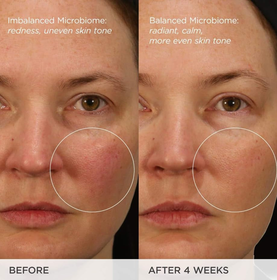 Replenishing Nourishment Duo: AM + PM Set, Dewy Skin Cream 1.7 Oz & Indigo Overnight Repair Serum 1.7 Oz ($164 Value)