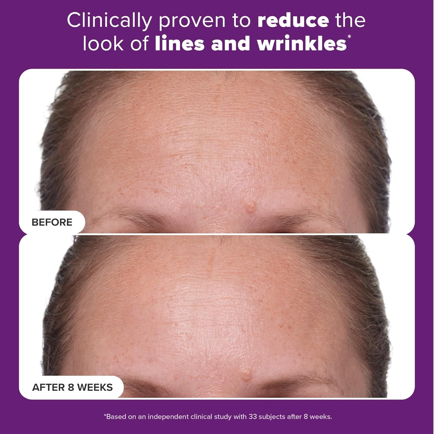 CLINICAL 1% Retinol Treatment with Peptides, Vitamin C & Licorice Extract, Firming Cream for Face, Anti-Aging & Wrinkles, Fragrance Free
