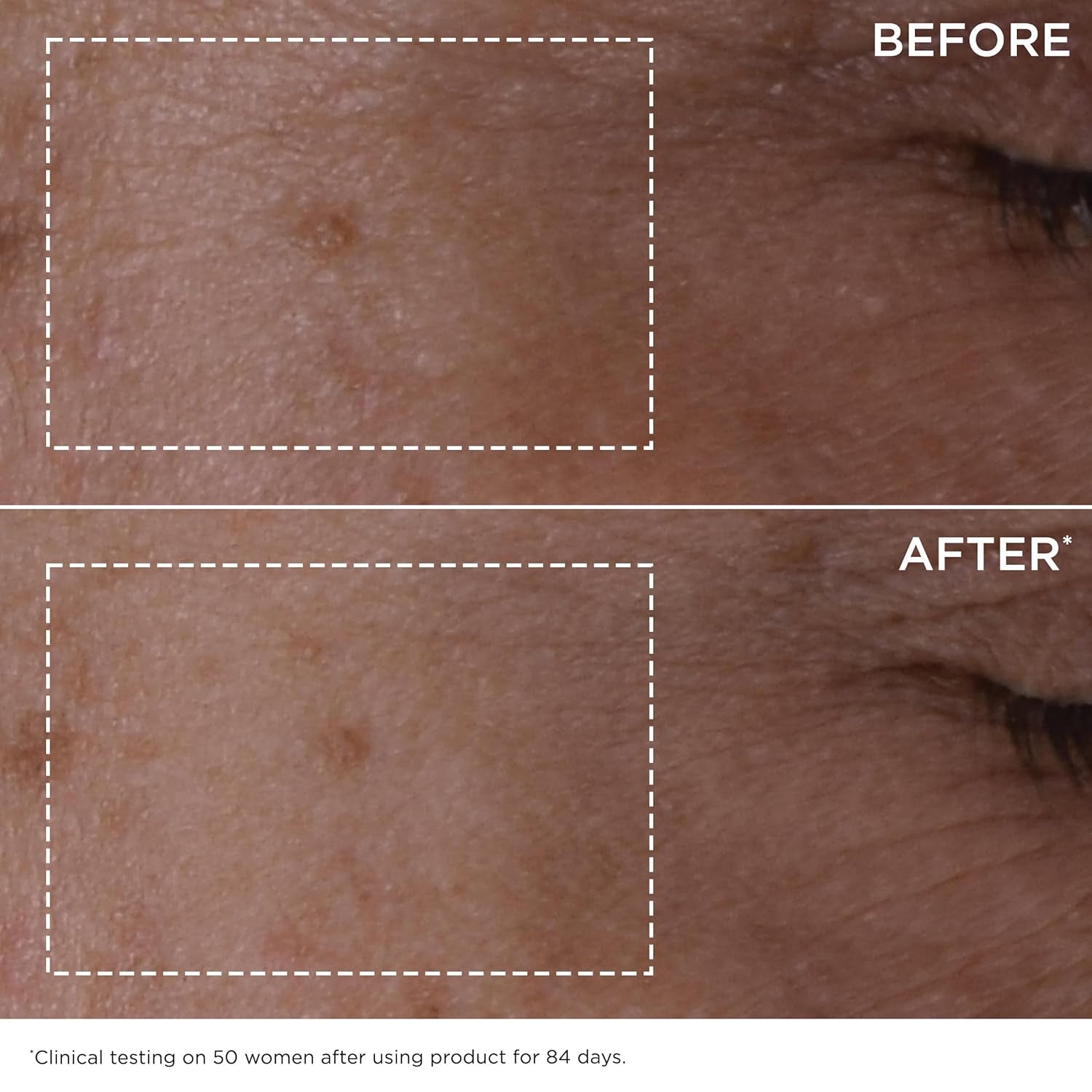 Double Serum | anti Aging Face Serum | Visibly Firms, Smoothes, Boosts Radiance, and Refines Pores | 24H Hydration | All Skin Types