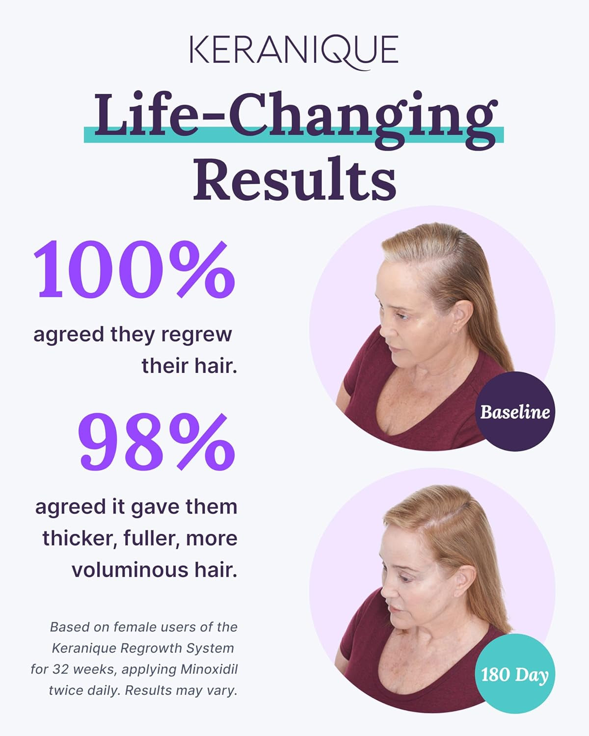 Hair Growth Products Set - 2% Minoxidil Hair Regrowth Treatment for Women - Deep Hydrating Shampoo and Conditioner - Hair Thickening & Volumizing Spray - Hair Loss Treatment System