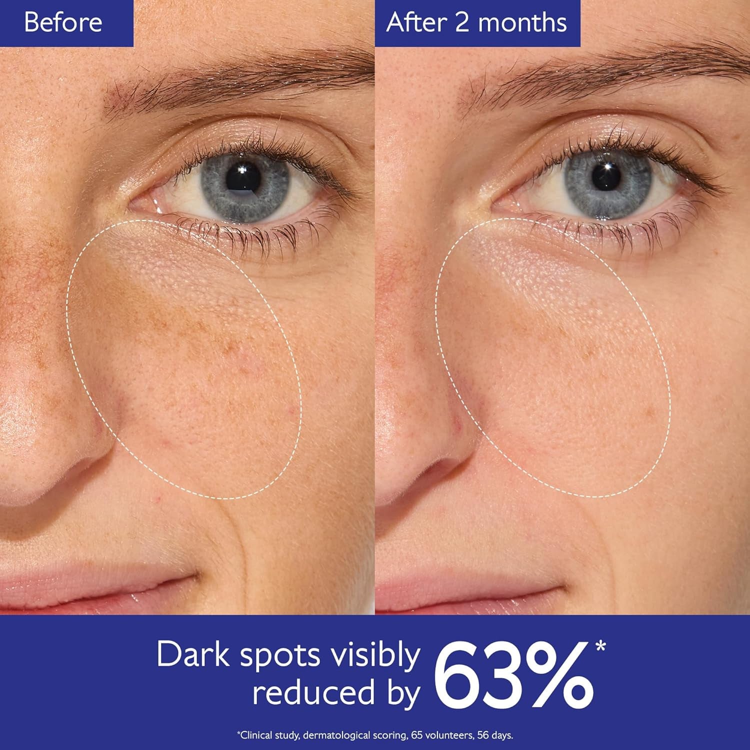 Vinoperfect Brightening Dark Spot Serum Vitamin C Alternative - 62X More Effective than Vitamin C with Viniferine for a Visibly Brighter Even Complexion