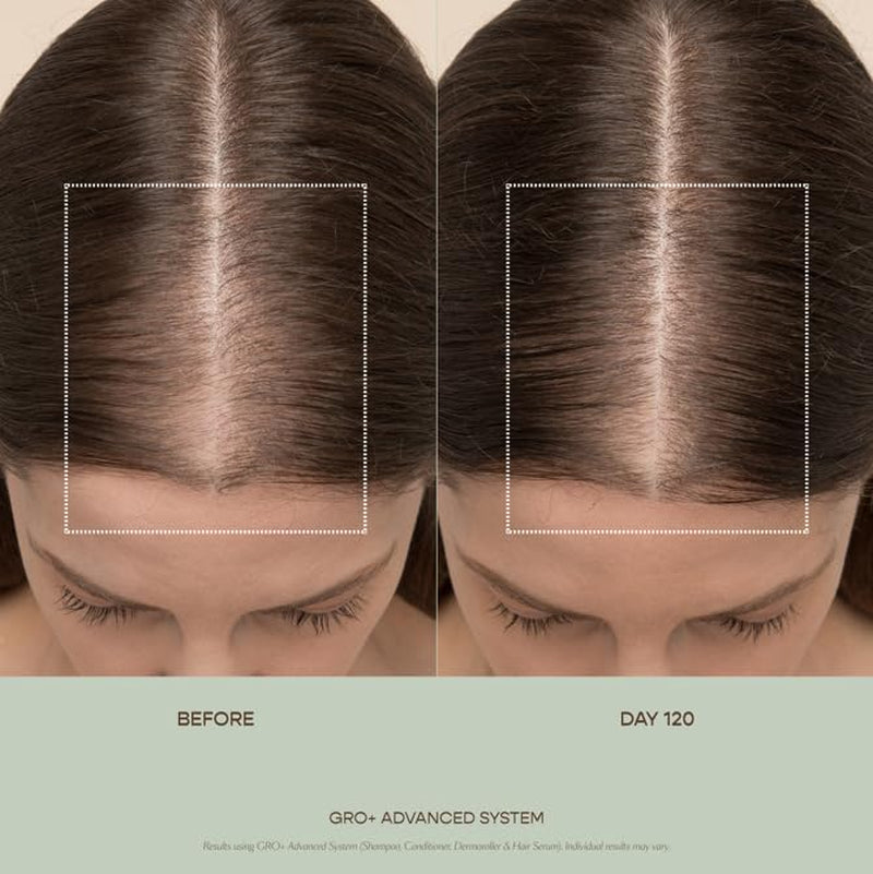 GRO+ Advanced Balancing Conditioner | Hydrates the Scalp, Nourishes and Softens Hair | for Severe Signs of Thinning | Color Safe, Vegan, Cruelty-Free, Formulated without Silicones (8 Fl Oz)