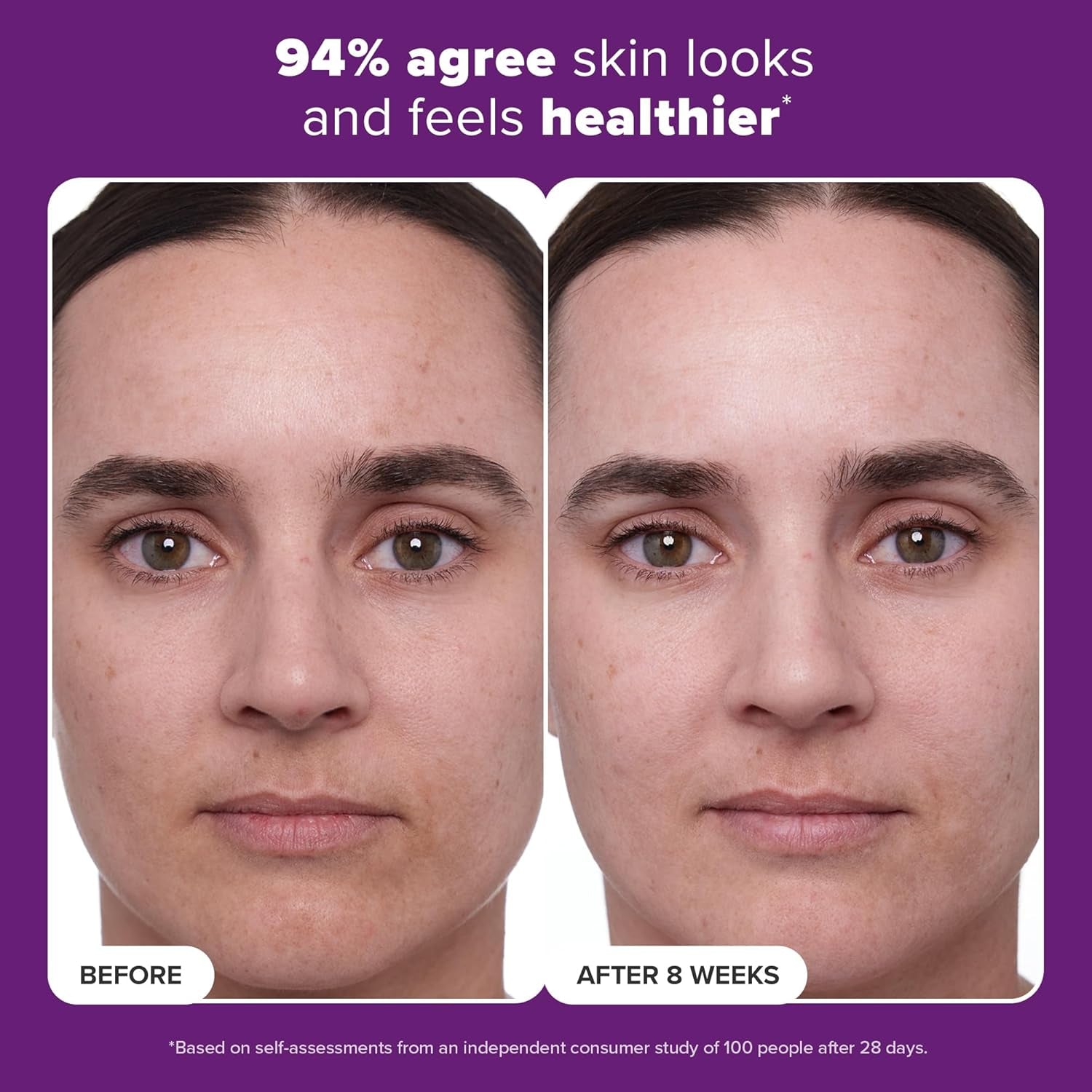 CLINICAL 1% Retinol Treatment with Peptides, Vitamin C & Licorice Extract, Firming Cream for Face, Anti-Aging & Wrinkles, Fragrance Free