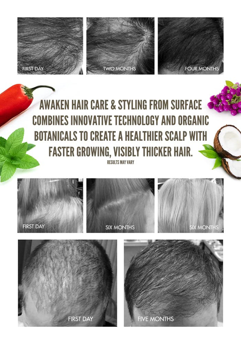 - Awaken Kit: Shampoo, Conditioner, Scalp Elixir and Therapeutic Treatment - for Thinning Hair, Hair Loss and Thickening