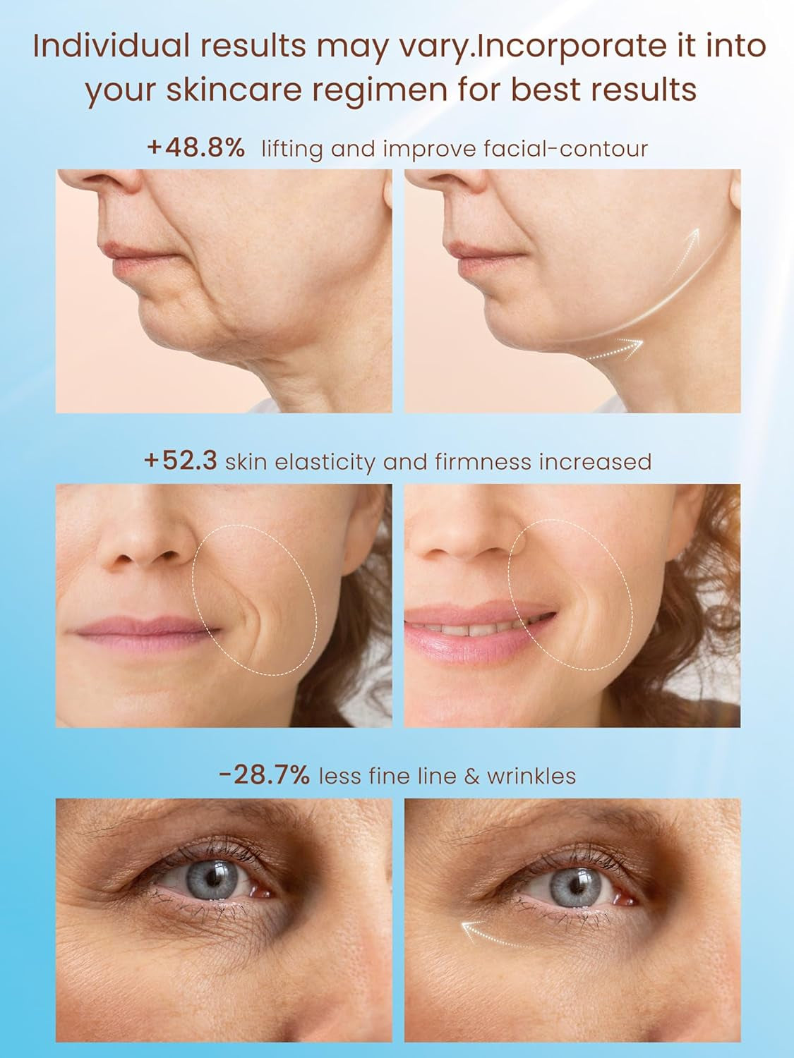 Radio Frequency Skin Tightening Device, Smart Eectric Zinc Aoy Facia Beauty Machine with Rf-Current Cod Heat for Jawine ifting, Cheek Firm, Wrinke Reduction, Depuff, Increase Absorption