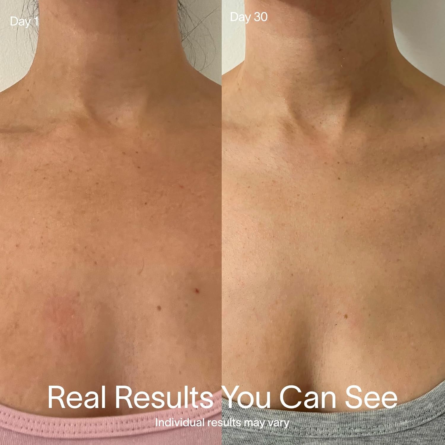 Red Light Therapy Mask for Neck & Chest | Red Light & near Infrared Light Device for Décolleté | Rejuvenates the Skin, Smooths Look of Fine Lines & Wrinkles | Anti-Aging Skincare at Home