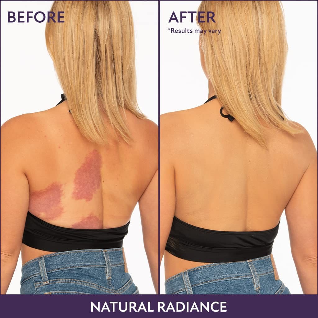 Body Coverage Perfector 2.5 Oz/ 74Ml (Natural Radiance) - Waterproof Leg and Body Makeup for Tattoo Cover up and More - the Best Tattoo Cover up Leg Makeup