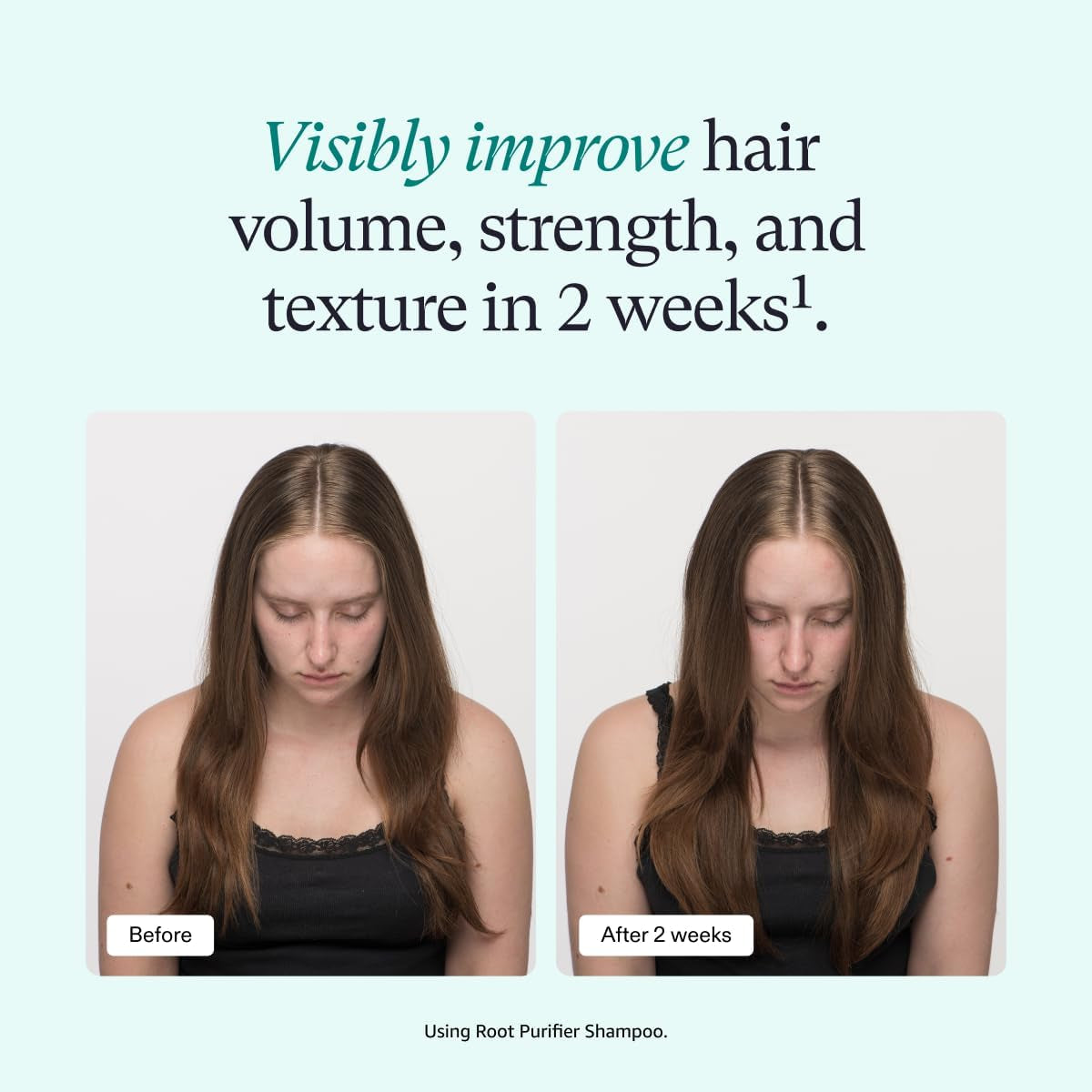 Shampoo, Cleanse and Hydrate Hair and Scalp, Improves Hair Volume, Strength and Texture, Physician-Formulated for Thinning Hair, Color Safe, Sulfate Free