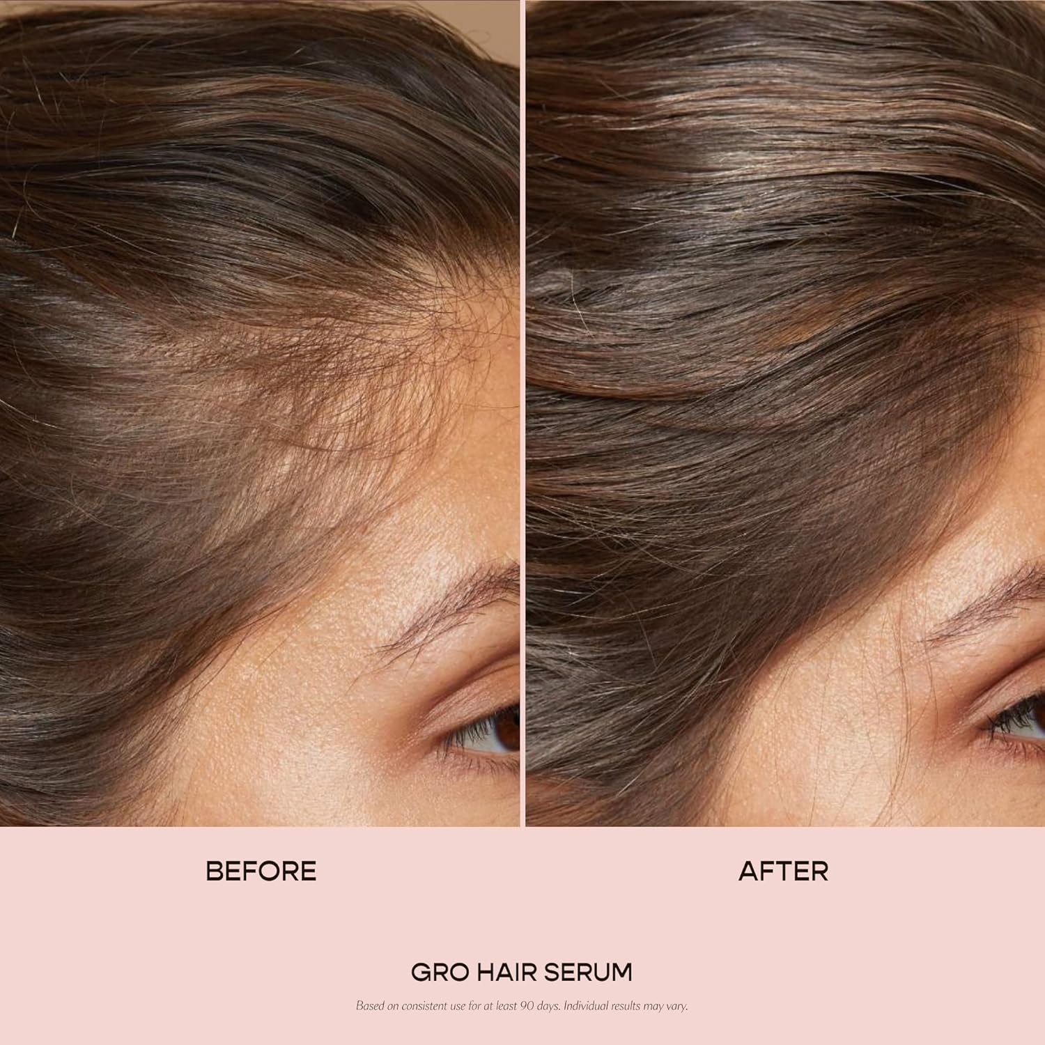 GRO Hair Serum for Hair Thinning & Shedding, Thicker Fuller Looking Hair in as Soon as 90 Days, Non Oily, Bergamot Scent, Vegan & Cruelty Free