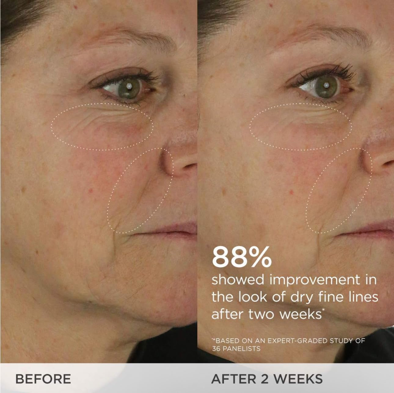 Replenishing Nourishment Duo: AM + PM Set, Dewy Skin Cream 1.7 Oz & Indigo Overnight Repair Serum 1.7 Oz ($164 Value)
