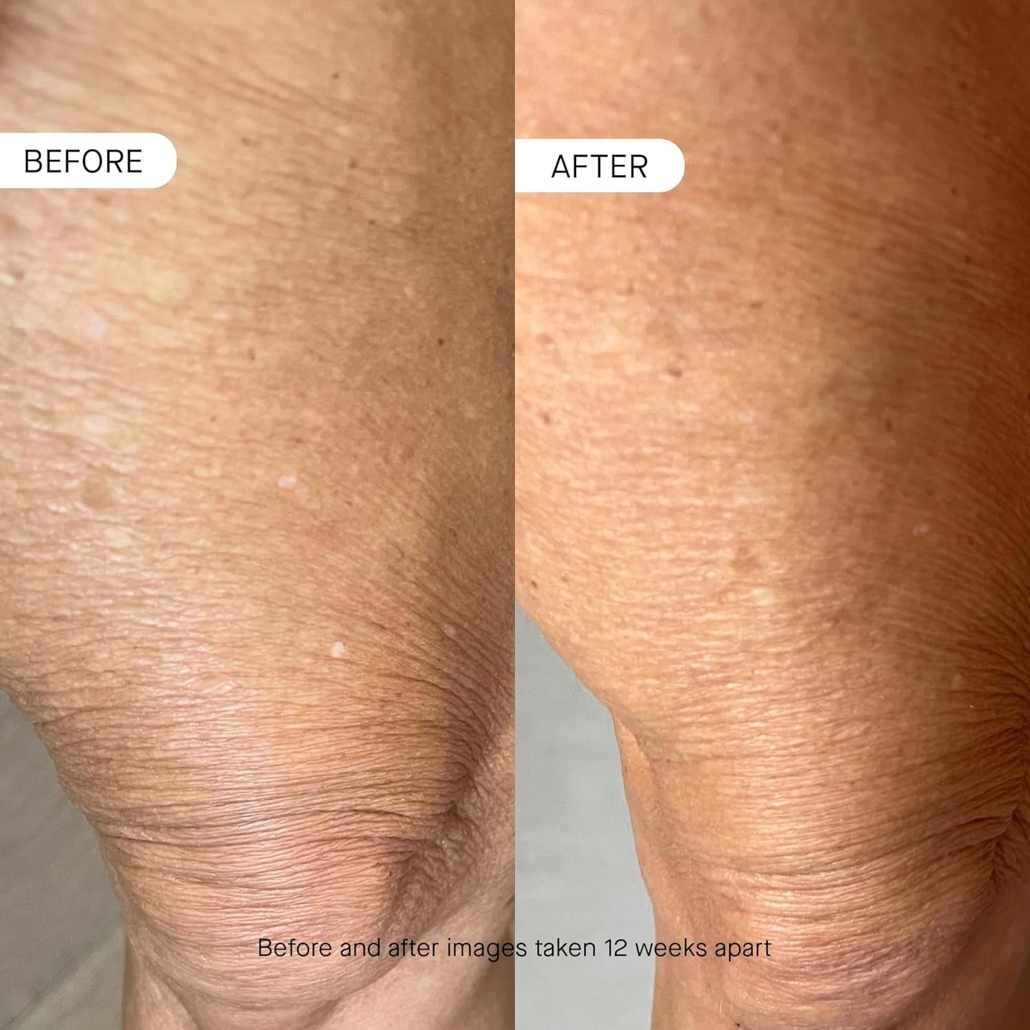 BODY OS-01 Peptide Skin Longevity Daily Moisturizer- Improves Skin Texture & Barrier, Safe for Sensitive Skin