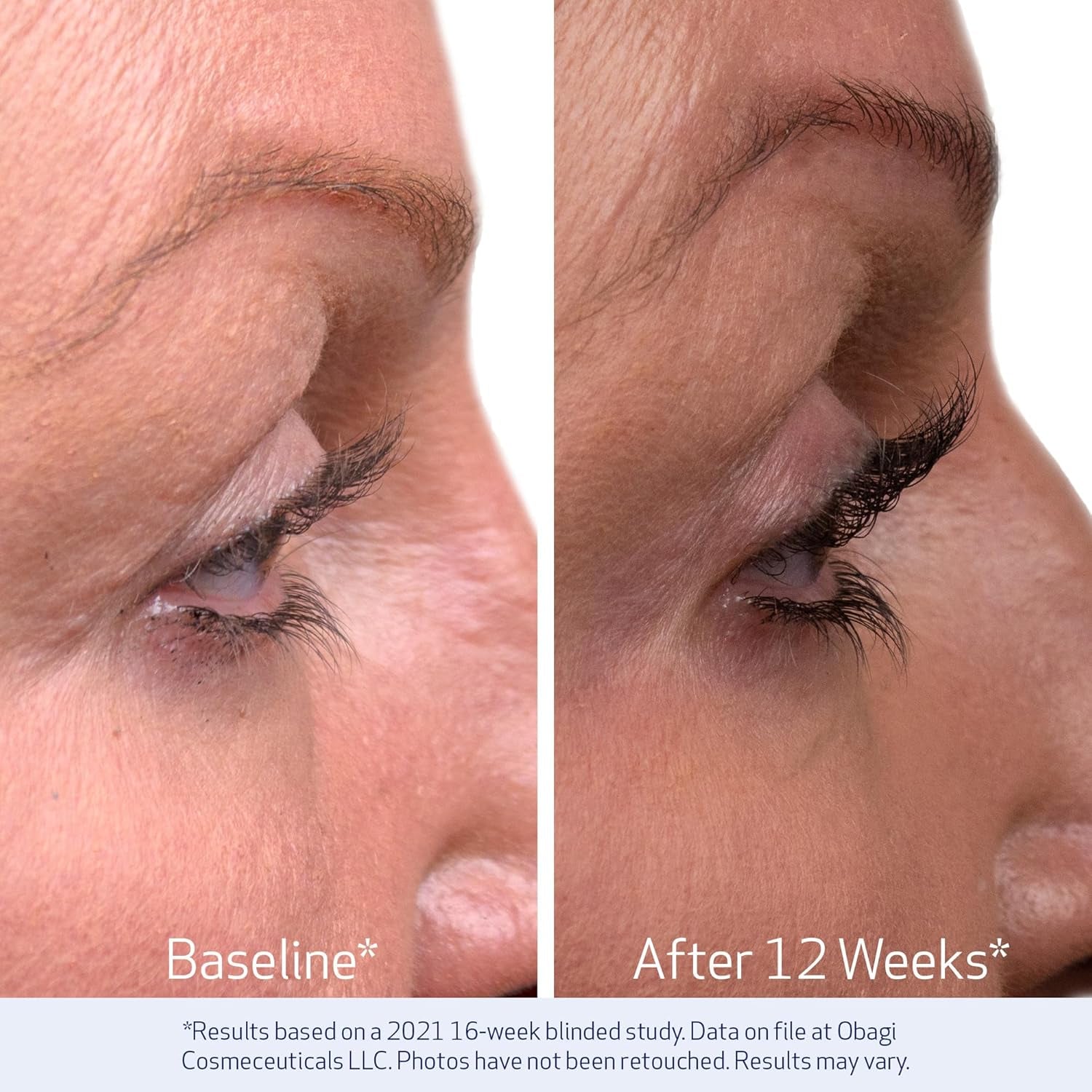 Obagi Nu-Cil Eyelash Enhancing Serum – Nourishing Lash Serum with Biotin for Thicker & More Defined-Looking Lashes