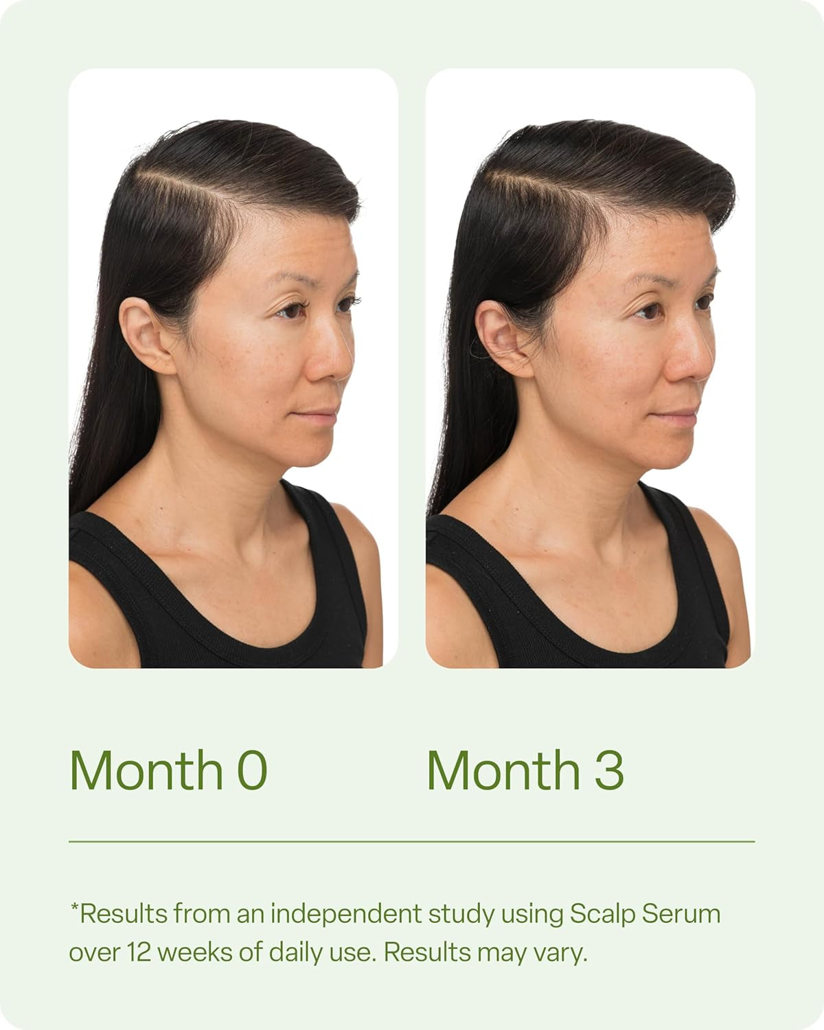 Scalp Serum for Thinning Hair - Clinically Tested Nourishing Formula with Amino Acids, Caffeine, and Rosemary Oil for Enhanced Scalp Health and Fuller Hair Appearance, Reduces Oil and Product Buildup