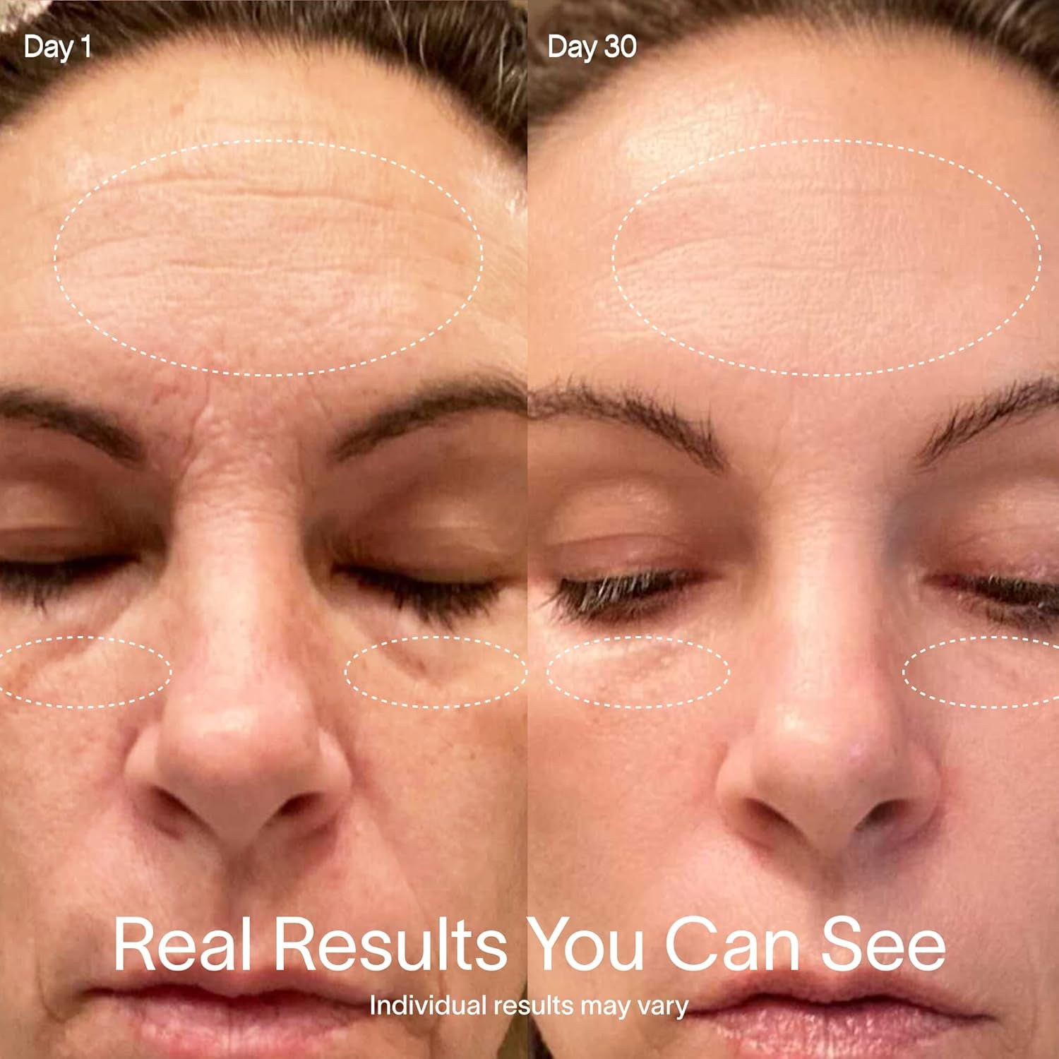 4-In-1 Red Light Facial Therapy Wand